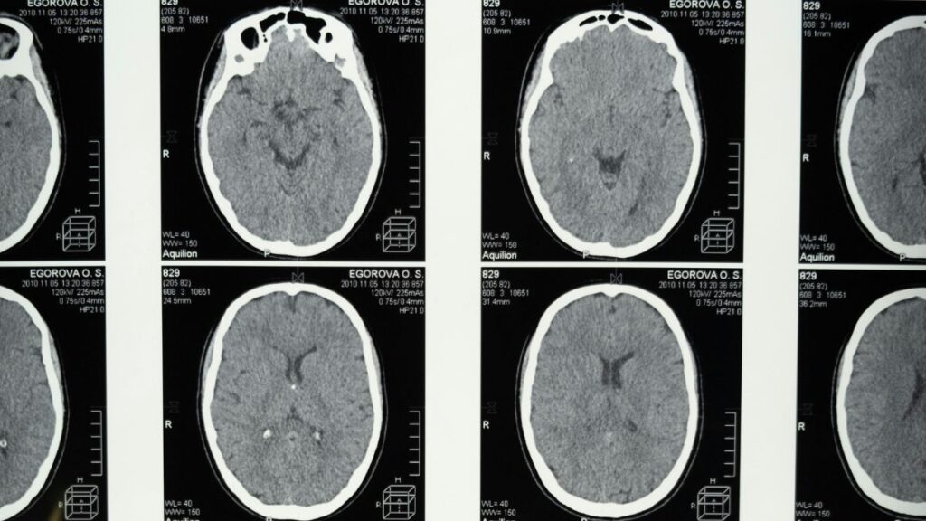 Reprogramação Mental: Ciência e Cosmos Alinhados